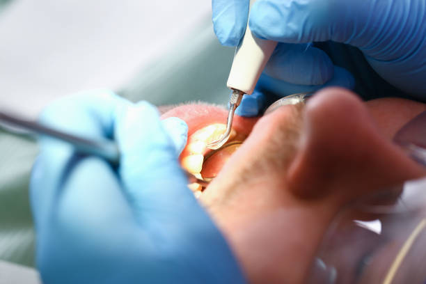 Best Chipped Tooth Repair Near Me  in Camden, TN