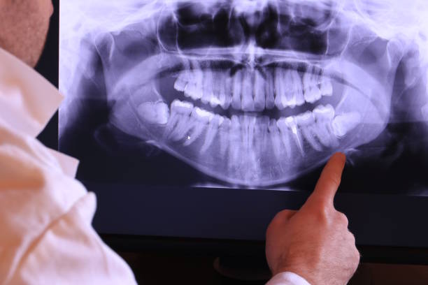 Emergency Dental Filling Replacement in TN