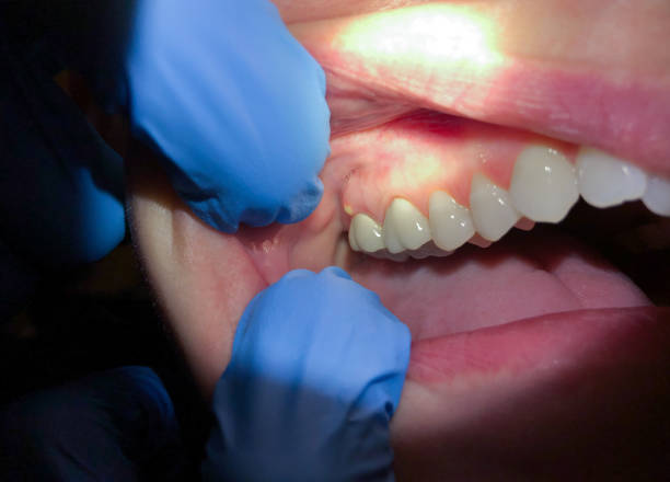 Best Urgent Tooth Repair  in Camden, TN