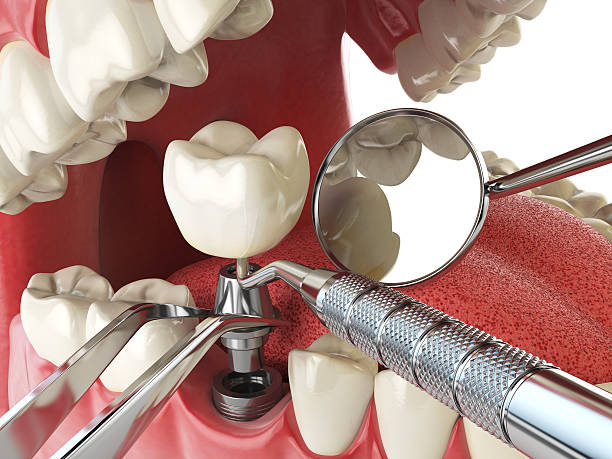 Best Broken Tooth Emergency  in Camden, TN