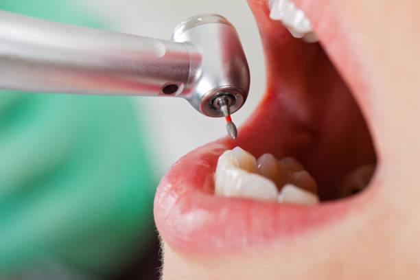 Best Tooth Infection Emergency Dentist  in Camden, TN